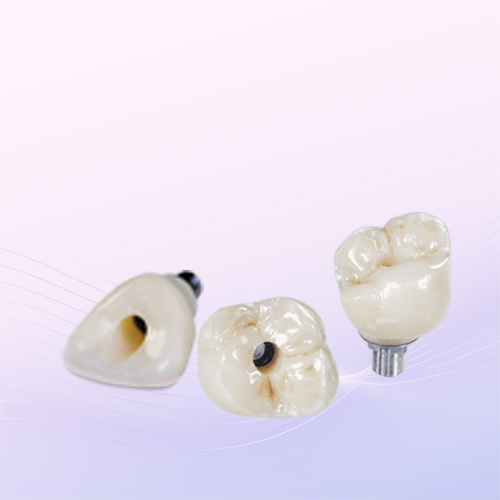 Sứ trên Implant